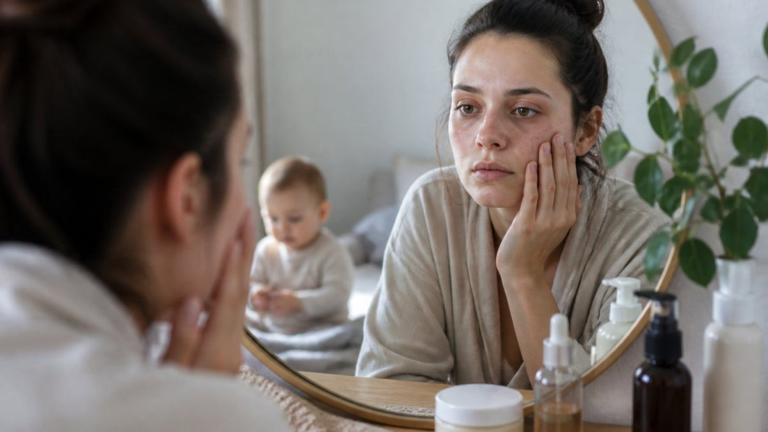 How to Fix Dull Skin After Pregnancy